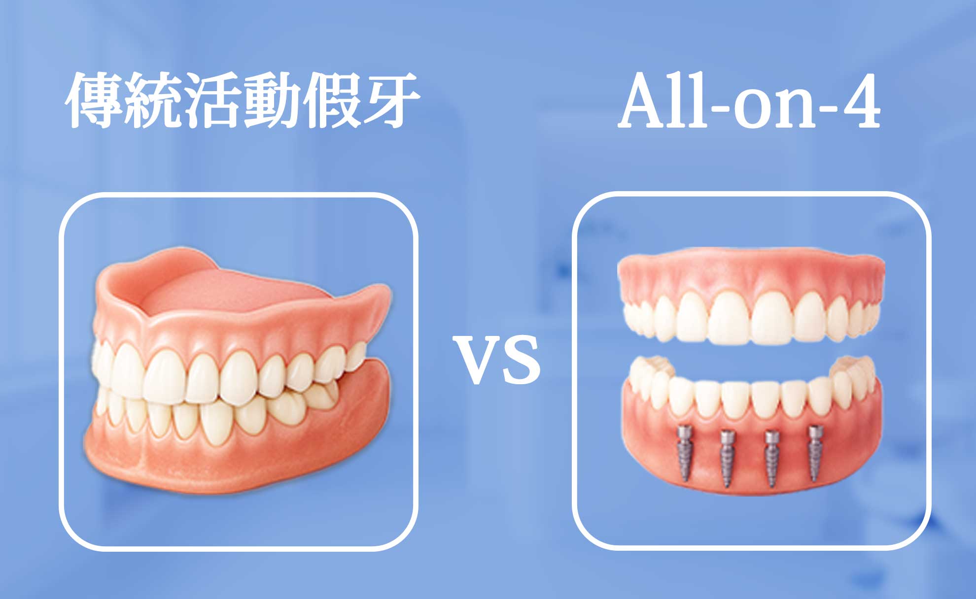 傳統活動假牙與 All-on-4 植牙對牙床骨影響的比較圖